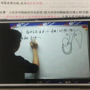 法洛四联症