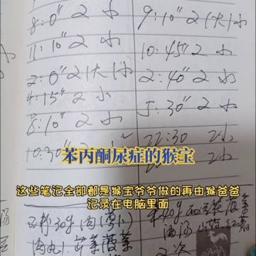 苯丙酮尿症